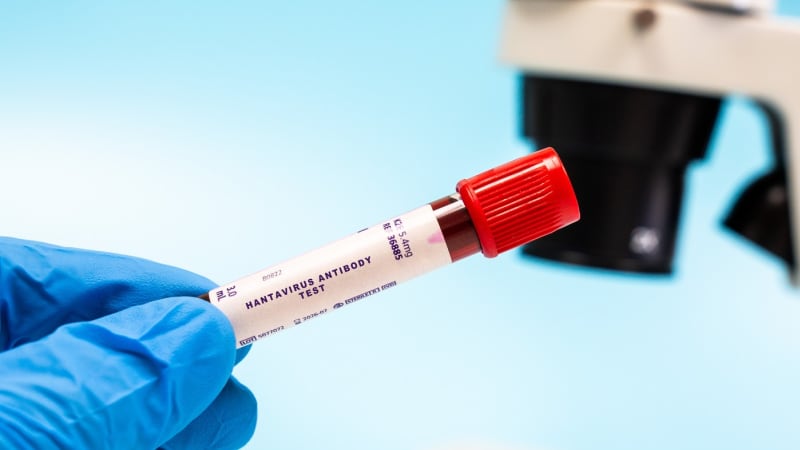 Smrtící hantavirus v Curychu: Nakaženým je pasažér z výletní lodi
